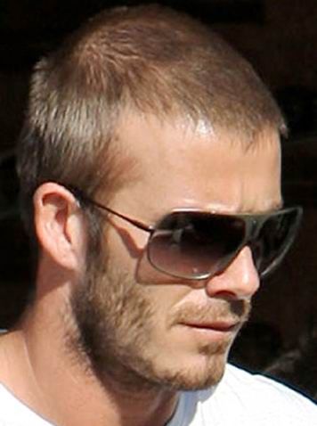 can rogaine regrow receding hairline